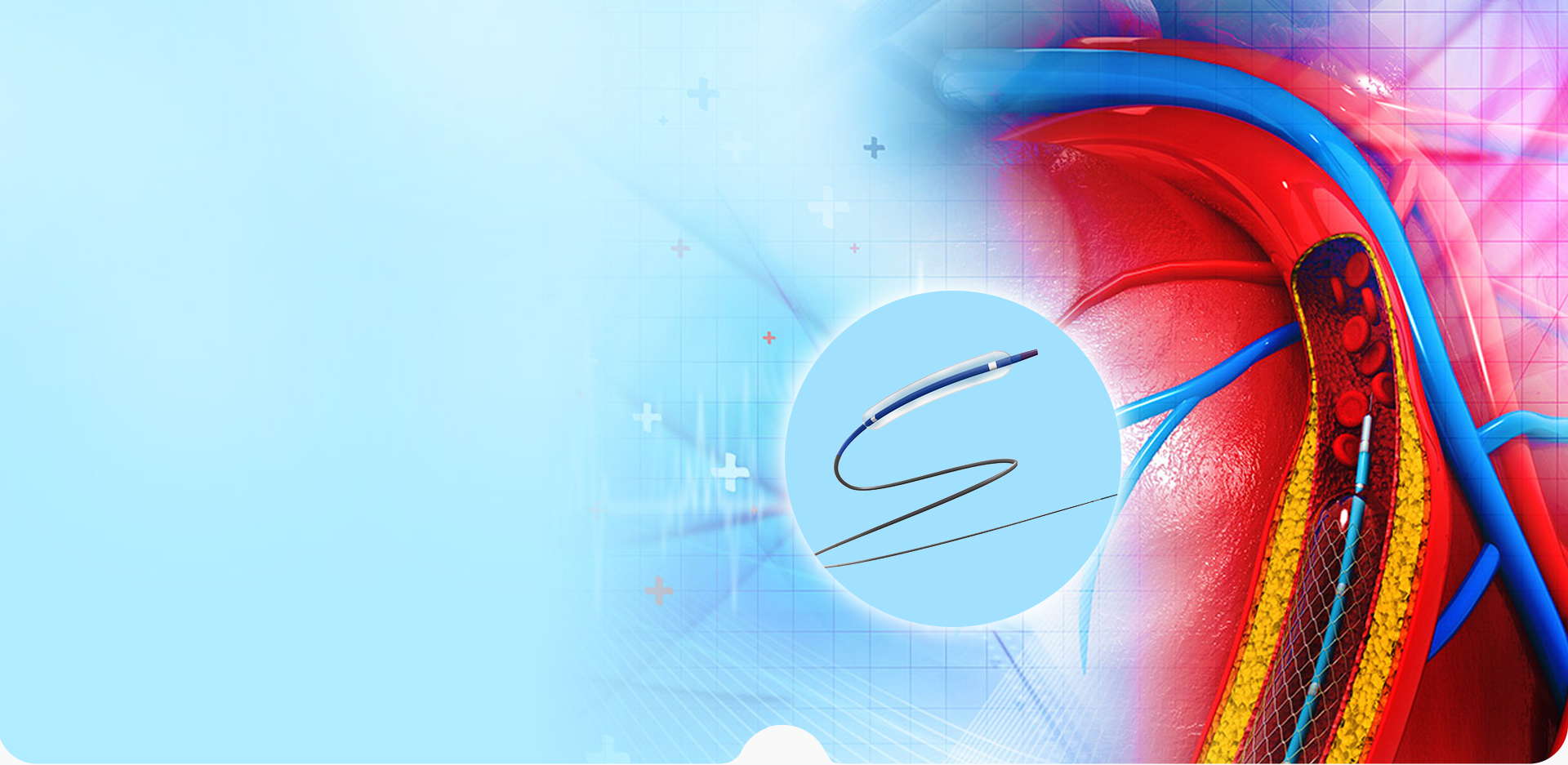 شركة نينغبو لينستانت لمواد البوليمر. المحدودة.