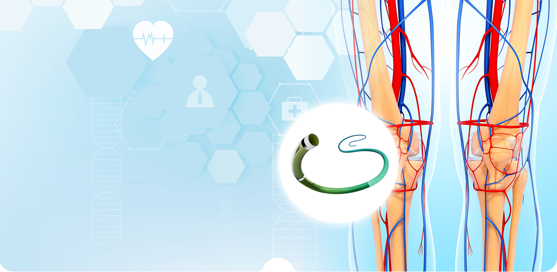 شركة نينغبو لينستانت لمواد البوليمر. المحدودة.